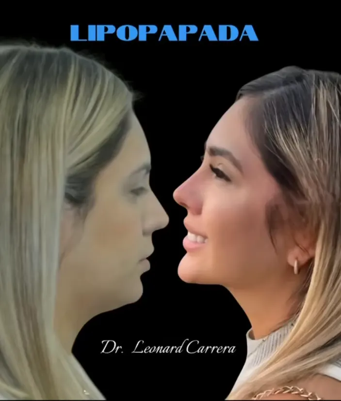 Caso dentofacial 15
