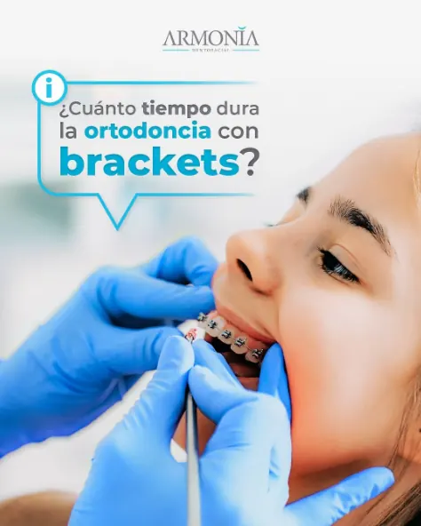 Brackets